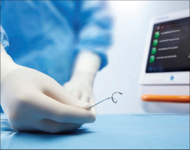  RDN | 經腎動脈去交感神經術&mdash;&mdash;高血壓微創(chuàng)介入治療