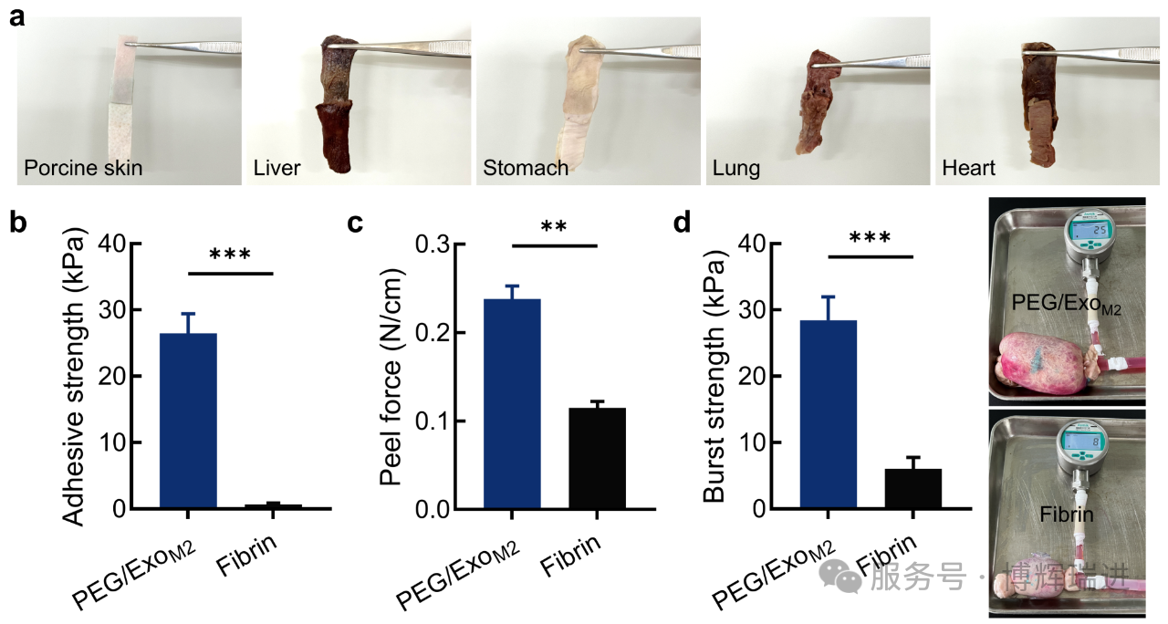可吸收醫(yī)用膠（博輝瑞進）